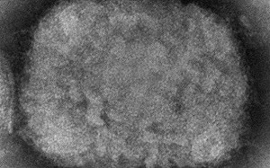 美國猴痘病例驗出兩種病毒株 恐存在尚未被發現的傳染