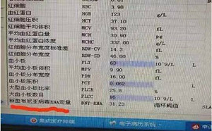 中國怪病特別多！河南3人因蜱蟲病逝 曾一同為去世感染者淨身