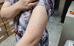 阻截禽蟎侵入生活空間   新北動保處提供除蟎小撇步