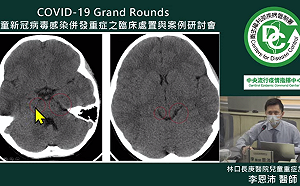 出現腦炎及休克症狀！7歲確診男童睡覺突睜眼大喊：我們都要死掉了