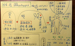 國內出現首例猴痘個案！傳染途徑多 皮膚科醫師繪圖曝解「沒傳染力」關鍵