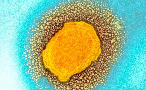 「猴痘」境外移入第4例 疾管署：入境有疑似症狀 主動告知