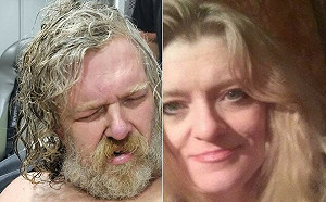 美女子遭砍被丟在路邊等死 昏迷2年後甦醒 指控兇手竟是親哥哥