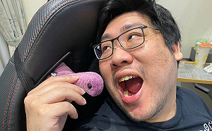 國動自曝最怕「拔智齒」！手術過程用想的就很恐怖