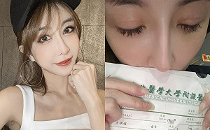 每年生日都出事！才出院1週   雪碧「發炎指數增加」再度就醫