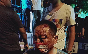 (影)苗栗坤輿夜襲爆衝突 民代批警放任黑衣人「鄉親頭破血流、休克」立委也被噴辣椒水