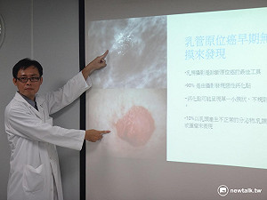 乳房原位癌5年存活率近100% 醫師籲及早篩檢