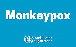 猴痘爆人傳狗首例 巴黎寵物犬主人保持距離仍中鏢