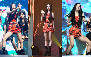 JYP虧待新人登微博！膝蓋大片瘀青粉絲怒：越做越差勁