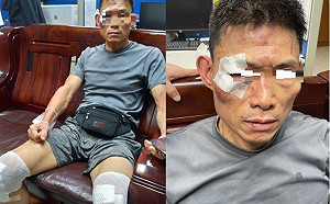 三重分局惱羞？警察暴打無辜路人後臉書遭怒灌 竟限縮民眾留言