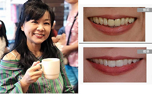 挺牙醫》王時齊露齒讚神醫 網轟李德維「無齒之人」