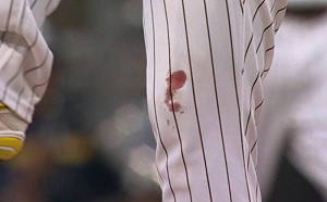 (影)浴血奮戰！達比修投到膝蓋流血