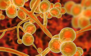 高達1/3感染者死亡! CDC :「超級真菌」襲美 一半以上的州淪陷
