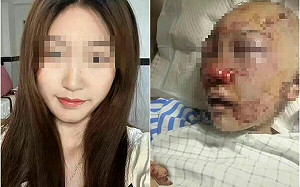 中國20歲網美上廁所被埋伏「摳眼拔舌」 磚頭暴打20分鐘滿頭血癱倒
