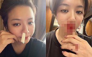 滿臉鮮血!李妍憬曝原因  網笑:你鼻血會止不了