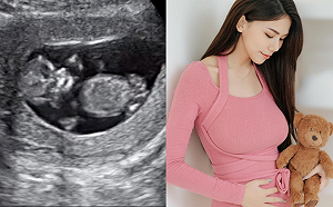 蕾菈二寶模樣首曝光！超音波畫面網狂猜性別