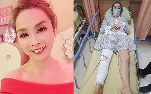 失足摔碎膝蓋！許聖梅淚訴：朋友全跑光