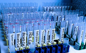 男生捐精爽賺8千！五大符合條件曝