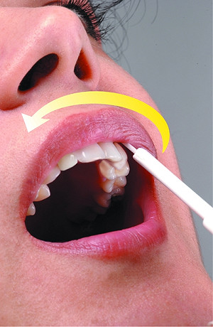 保障隱私 愛滋病毒唾液試劑可在家篩檢