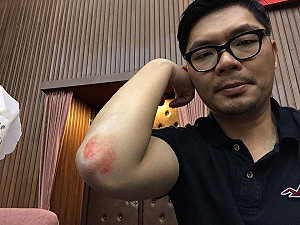 搶主席台　許毓仁仆倒掛彩、吳秉叡說絕對沒有推