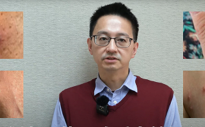 快訊》本土猴痘再＋１！台北30多歲男四肢軀幹現膿疱  匡列18名接觸者