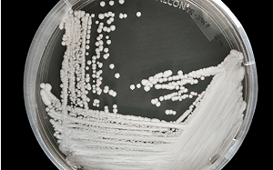 美國爆千人感染耳念珠菌！抗藥性高、1/3患者90天內亡 