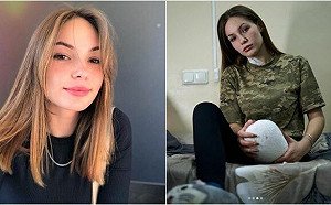 ｢抱著膝蓋發現小腿沒了｣ 19歲烏克蘭女兵勇敢面對：保家衛國不後悔