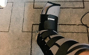 貪玩誤事！《英雄聯盟》選手賽前韌帶扭傷