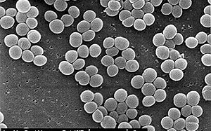 癌細胞擦擦就沒了！史丹佛大學大突破 : 改造細菌CD8 T可用來殺死腫瘤