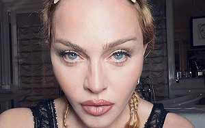 瑪丹娜病情好轉！嚴重細菌感染住院 已脫離險境返家休養