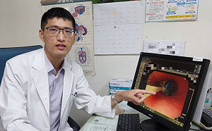 傻眼！男子竟吞11顆3號電池　專業醫曝「取物」過程