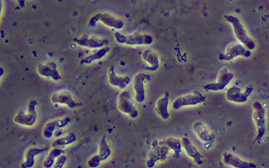 北部女玩水染食腦變形蟲亡！衛生局曝最新疫調：只去新北一處親水設施