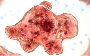 「食腦變形蟲」是什麼？美國上月底也曾出現案例 症狀有這些...