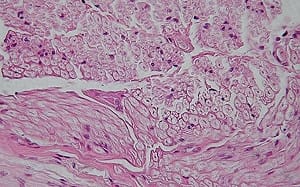 重大突破！科學家開發新材料 被切斷的神經 可靠這東西連接....