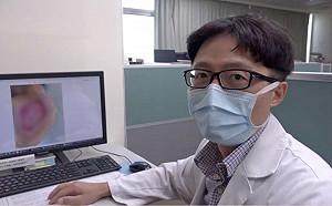 ６旬婦長「疔子」 擠膿敷草藥險致命！醫警告「這類人」：別自行處理傷口