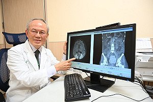 紅斑性狼瘡被稱「偉大的模仿者」 與多種疾病初期症狀相似