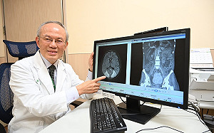 紅斑性狼瘡被稱「偉大的模仿者」 與多種疾病初期症狀相似