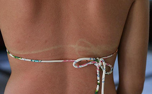 高溫炎熱！ 小心熱傷害風險增