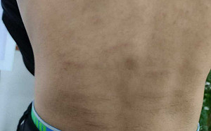 桃園警分局驚傳刑求！少年慘遭電擊棒凌虐