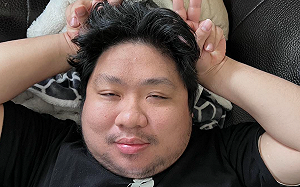 統神驚爆「背上長腫瘤」？本人親曝病因