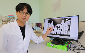 男童門牙少一顆說話漏風 竟是牙齦內的阻生齒作祟