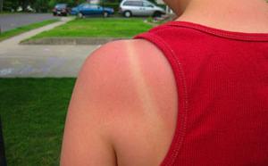 紫外線全台狂飆 陽光下20分鐘就曬傷