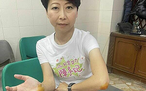 立院衝突掛彩！承認故意絆倒陳亭妃 : 準備向徐巧芯提告