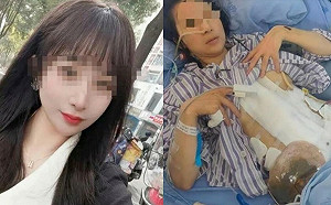 中國悲歌! 四川女遭家暴16次｢醒來正被性侵｣終身掛糞袋還離不了婚 