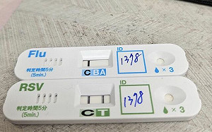 RSV夏天異常現蹤！醫籲：幼童高燒咳不停快就醫