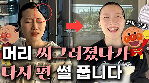 南韓空姐網紅摔倒「左頭蓋骨被削」!「2次手術接回」激動洩心聲