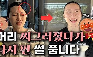 南韓空姐網紅摔倒「左頭蓋骨被削」！「2次手術接回」激動洩心聲