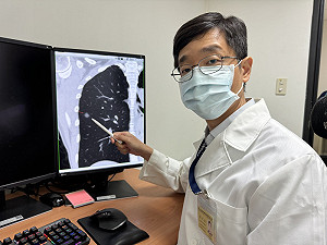 47歲女不抽菸、有家族病史 篩檢揪出肺腺癌!