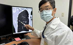 47歲女不抽菸、有家族病史 篩檢揪出肺腺癌！