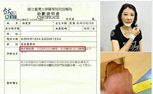 林楚茵掛彩驗完傷：立委沒有暴力免責權 我會提告